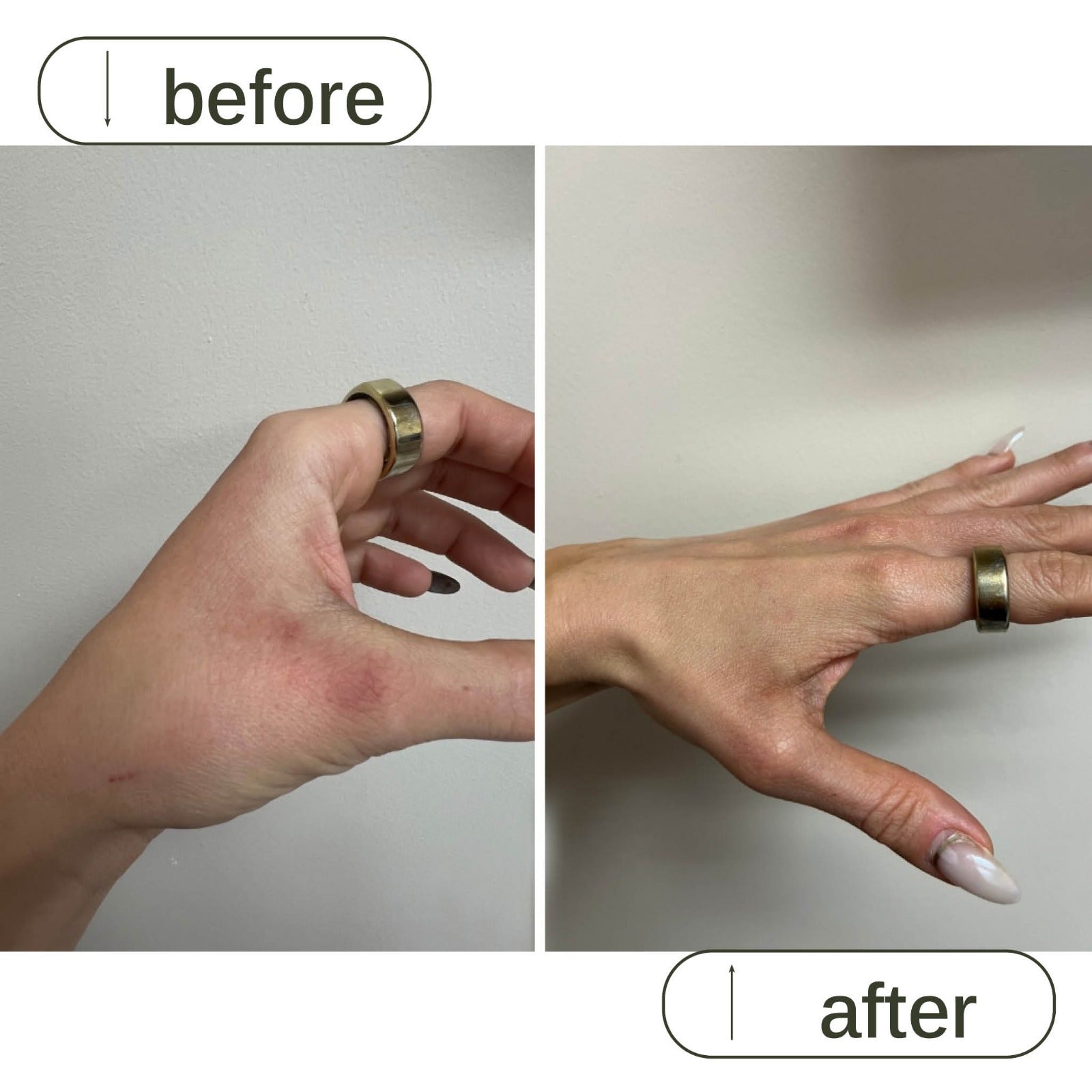 Alcohol free hand sanitizer