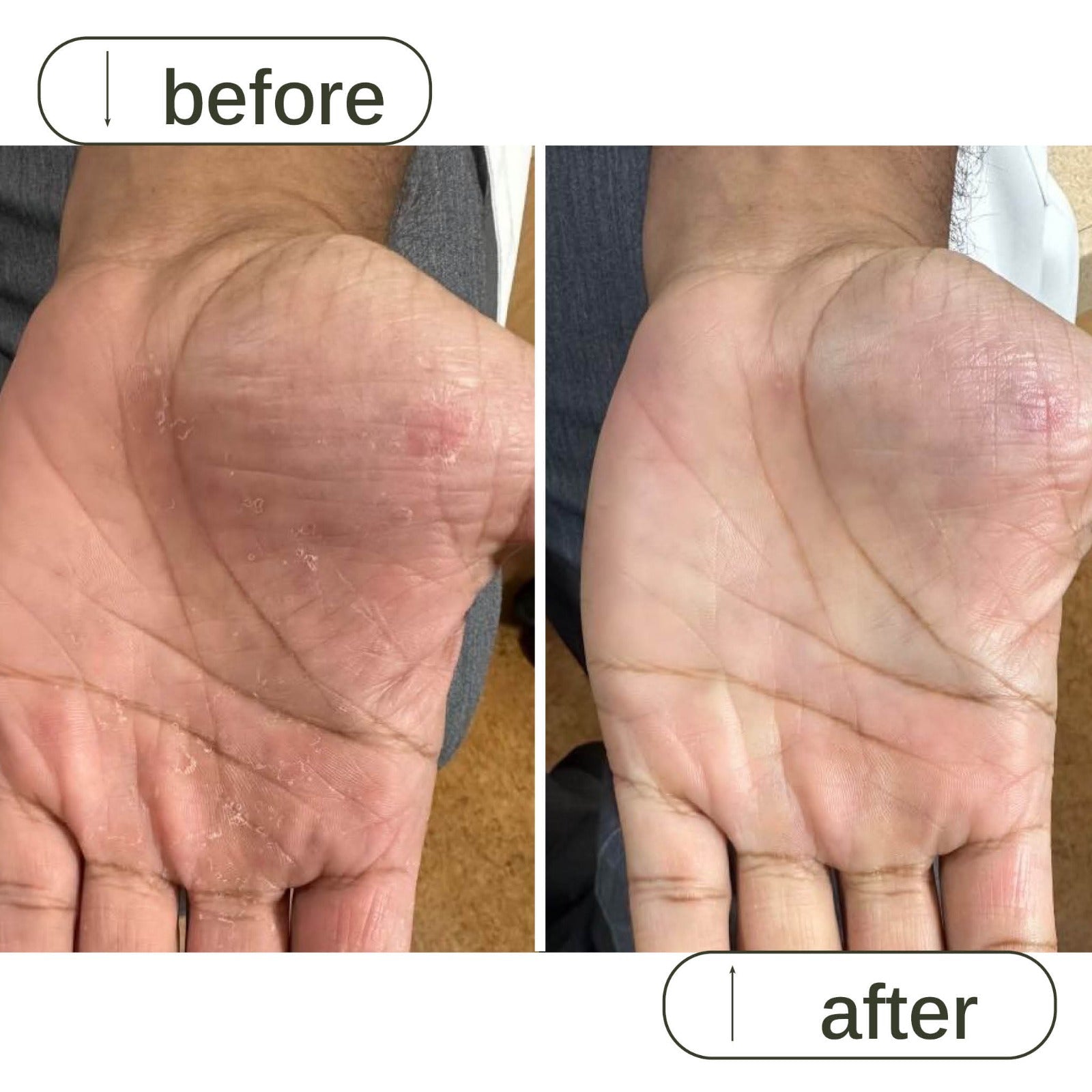 Alcohol free hand sanitizer